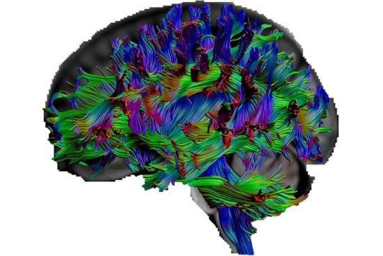 Κουλτούρα δημιουργεί καλύτερο νευρωνικό δίκτυο για τον εγκέφαλο